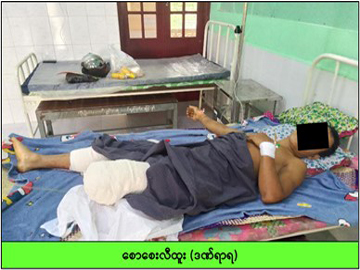 တနင်္သာရီတိုင်းဒေသကြီး၊ ထားဝယ်မြို့နယ်၌ လက်နက်ကိုင်အကြမ်းဖက်သမားများက လက်နက်ကြီးများဖြင့် ပစ်ခတ်တိုက်ခိုက်မှုကြောင့် အပြစ်မဲ့ အရပ်သားပြည်သူ တစ်ဦး ထိခိုက်ဒဏ်ရာရရှိ