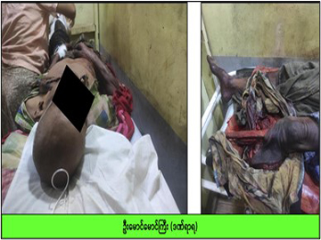 ဧရာဝတီတိုင်းဒေသကြီး၊ သာပေါင်းမြို့နယ်၌ AA အကြမ်းဖက်သောင်းကျန်းသူများနှင့် PDF အမည်ခံ အကြမ်းဖက်သမားများ ပူးပေါင်းအဖွဲ့က ထောင်ထားသည့် နင်းမိုင်း တစ်လုံး ပေါက်ကွဲမှုကြောင့် အပြစ်မဲ့ အရပ်သားပြည်သူ တစ်ဦး ထိခိုက်ဒဏ်ရာရရှိ