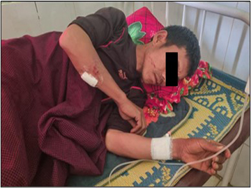 ရှမ်းပြည်နယ်(တောင်ပိုင်း)၊ ဆီဆိုင်မြို့နယ်၌ အကြမ်းဖက်အဖွဲ့(စိစစ်ဆဲ)က ထောင်ထားသည့် မိုင်း တစ်လုံး ပေါက်ကွဲခဲ့မှုကြောင့် အပြစ်မဲ့အရပ်သားပြည်သူ တစ်ဦး ထိခိုက်ဒဏ်ရာရရှိ