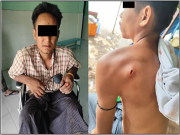 မန္တလေးတိုင်းဒေသကြီး၊ မြင်းခြံမြို့နယ်၌ အကြမ်းဖက်အဖွဲ့(စိစစ်ဆဲ) ထောင်ထားသည့် လက်လုပ်မိုင်း ပေါက်ကွဲမှုကြောင့် အပြစ်မဲ့ အရပ်သားပြည်သူနှစ်ဦးထိခိုက်ဒဏ်ရာရရှိ