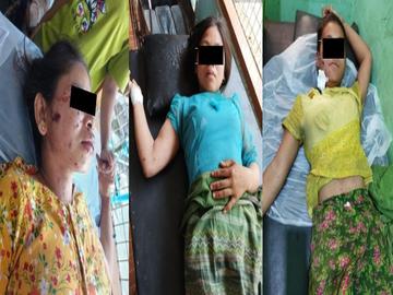 မကွေးတိုင်းဒေသကြီး၊ ပွင့်ဖြူမြို့နယ်၌ PDF အမည်ခံ အကြမ်းဖက်အဖွဲ့ထောင်ထားသည့် လက်လုပ်တိုက်မိုင်း တစ်လုံး ပေါက်ကွဲခဲ့မှုကြောင့် အပြစ်မဲ့ အရပ်သားပြည်သူ သုံးဦး ထိခိုက်ဒဏ်ရာရရှိ