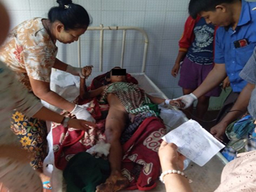 စစ်ကိုင်းတိုင်းဒေသကြီး၊ ကသာမြို့နယ်၌ KIA လက်နက်ကိုင်သောင်းကျန်းသူအဖွဲ့နှင့် PDF အမည်ခံ အကြမ်းဖက်သမားများ ပူးပေါင်းအဖွဲ့ထောင်ထားသည့် မိုင်း တစ်လုံး ပေါက်ကွဲခဲ့မှုကြောင့် အပြစ်မဲ့ ကလေးငယ် တစ်ဦး ထိခိုက်ဒဏ်ရာရရှိ