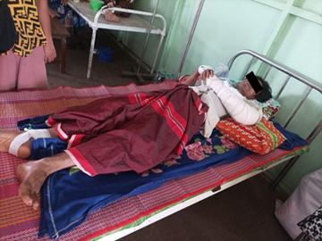 ကရင်ပြည်နယ်၊ သံတောင်ကြီးမြို့နယ်၌ PDF အမည်ခံ အကြမ်းဖက်အဖွဲ့က ကျေးရွာအတွင်းသို့ လက်နက်ကြီးဖြင့် ပစ်ခတ်တိုက်ခိုက်ခဲ့မှုကြောင့် အပြစ်မဲ့ အရပ်သားပြည်သူတစ်ဦးသေဆုံးကာ တစ်ဦး ထိခိုက်ဒဏ်ရာရရှိ