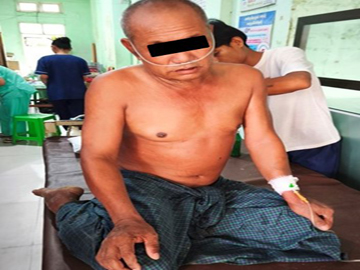စစ်ကိုင်းတိုင်းဒေသကြီး၊ ရွှေဘိုမြို့နယ်၌ PDF အမည်ခံ အကြမ်းဖက်အဖွဲ့က ပစ်ခတ်သတ်ဖြတ်မှုကြောင့် အပြစ်မဲ့ အရပ်သားပြည်သူ တစ်ဦး ထိခိုက်ဒဏ်ရာရရှိ