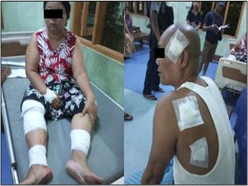 ပဲခူးတိုင်းဒေသကြီး၊ ကျောက်တံခါးမြို့နယ်၌ PDF အမည်ခံ အကြမ်းဖက်သမားများက လက်ပစ်ဗုံးဖြင့် ပစ်ပေါက်ခဲ့မှုကြောင့် အပြစ်မဲ့ အရပ်သားပြည်သူ နှစ်ဦး ထိခိုက်ဒဏ်ရာရရှိ