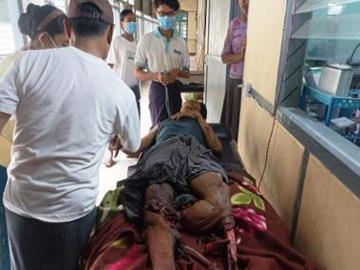 မကွေးတိုင်းဒေသကြီး၊ ပေါက်မြို့နယ်၌ PDF အမည်ခံ အကြမ်းဖက်အဖွဲ့ ထောင်ထားသည့် နင်းမိုင်း တစ်လုံး ပေါက်ကွဲခဲ့မှုကြောင့် အပြစ်မဲ့ အရပ်သားပြည်သူ တစ်ဦး ထိခိုက်ဒဏ်ရာရရှိ 