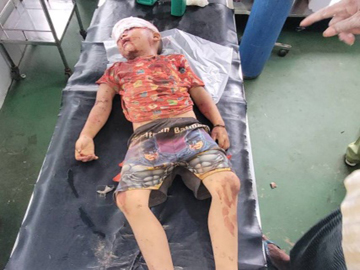 ပဲခူးတိုင်းဒေသကြီး၊ ဖြူးမြို့နယ်၌ KNLA အဖွဲ့နှင့် PDF အမည်ခံ အကြမ်းဖက်သမားများ ပူးပေါင်းအဖွဲ့က ကျေးရွာအတွင်းသို့ တိုက်ပွဲဖော်ဆောင်၍ ပစ်ခတ်တိုက်ခိုက်ခဲ့မှုကြောင့် ကလေးငယ်များအပါအဝင် အပြစ်မဲ့ အရပ်သားပြည်သူ သုံးဦး သေဆုံးကာ ၂၅ ဦး ထိခိုက်ဒဏ်ရာရရှိ