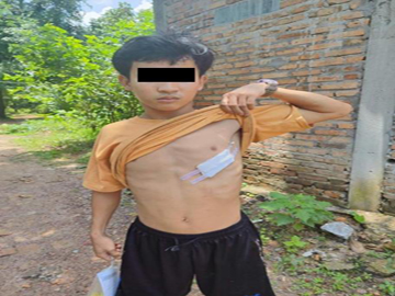 ကရင်ပြည်နယ်၊ ကော့ကရိတ်မြို့နယ်၌ အကြမ်းဖက်အဖွဲ့(စိစစ်ဆဲ)က ကျေးရွာအတွင်းသို့ ရှော့တိုက်ဒုံး များဖြင့် ပစ်ခတ်တိုက်ခိုက်ခဲ့မှုကြောင့် အပြစ်မဲ့ အရပ်သားပြည်သူ တစ်ဦး ထိခိုက်ဒဏ်ရာရရှိ