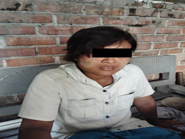 မန္တလေးတိုင်းဒေသကြီး၊ မတ္တရာမြို့နယ်၌ PDF အမည်ခံ အကြမ်းဖက်အဖွဲ့(စိစစ်ဆဲ)က ကျေးရွာအတွင်းသို့ လက်နက်ကြီးဖြင့် ပစ်ခတ်တိုက်ခိုက်ခဲ့မှုကြောင့် အပြစ်မဲ့ အရပ်သားပြည်သူ တစ်ဦး ထိခိုက်ဒဏ်ရာရရှိ