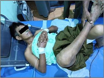 မန္တလေးတိုင်းဒေသကြီး၊ ပျော်ဘွယ်မြို့နယ်၌ PDF အမည်ခံ အကြမ်းဖက်သမားများက လုပ်ကြံသတ်ဖြတ်မှုကြောင့် ရာအိမ်မှူး တစ်ဦး ထိခိုက်ဒဏ်ရာရရှိ