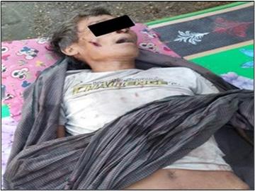 မကွေးတိုင်းဒေသကြီး၊ ပေါက်မြို့နယ်၌ PDF အမည်ခံ အကြမ်းဖက်အဖွဲ့က ထောင်ထားသည့် နင်းမိုင်း တစ်လုံး ပေါက်ကွဲခဲ့မှုကြောင့် အပြစ်မဲ့ အရပ်သားပြည်သူ တစ်ဦး သေဆုံး