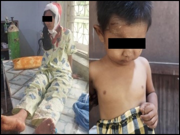 ပဲခူးတိုင်းဒေသကြီး၊ မင်းလှမြို့နယ်၌ PDF အမည်ခံ အကြမ်းဖက်အဖွဲ့က အများပြည်သူ ထိခိုက်စေရန် ရည်ရွယ်၍ လက်နက်ကြီးဖြင့် ပစ်ခတ်ခဲ့မှုကြောင့် ကလေးငယ်တစ်ဦးအပါအဝင် အပြစ်မဲ့ အရပ်သား ပြည်သူနှစ်ဦး ထိခိုက်ဒဏ်ရာရရှိ